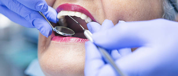 Best Emergency Cosmetic Dentistry (e.g., broken veneers) in Wyanet, IL